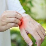 sivrisinek-isirmasindan-sonra-yuksek-ates-ve-eklemlerde-agri-varsa-mutlaka-doktorunuza-danisin-mEzc1DaP.jpg