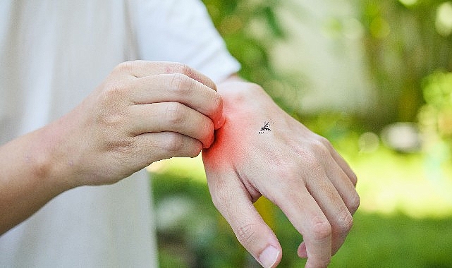 sivrisinek-isirmasindan-sonra-yuksek-ates-ve-eklemlerde-agri-varsa-mutlaka-doktorunuza-danisin-mEzc1DaP.jpg